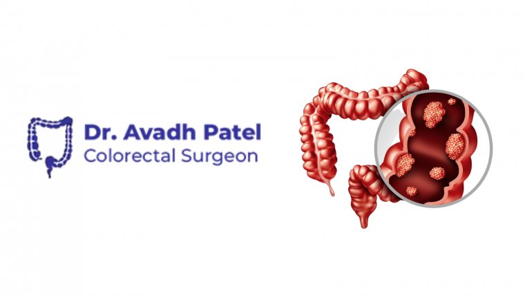 Dr Avadh  Patel